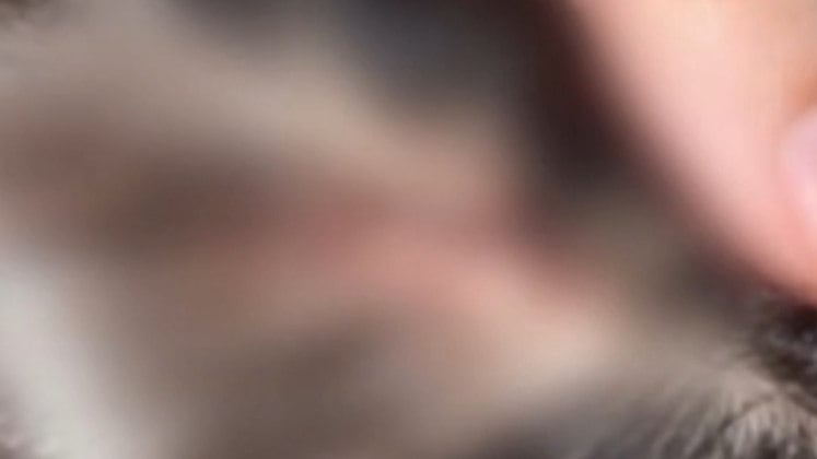 Em uma foto tirada por Jenifer, é possível ver que ela tinha um ferimento na cabeça depois de uma suposta agressão praticada por Gabriel. Contudo, o homem nega ter feito algo contra a vida da namorada