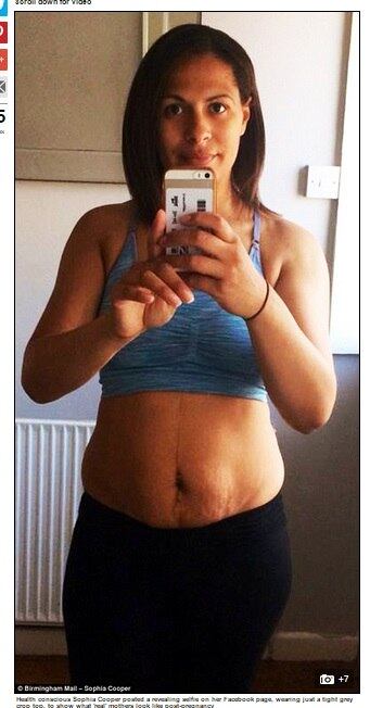Depois
de ver incontáveis fotos de mulheres comuns e celebridades que acabaram de
parir já usando biquíni e exibindo a mais perfeita forma física na internet,
uma mulher  resolveu mostrar ao mundo
como uma mãe “de verdade” realmente fica depois de uma gravidez.


Sophia
Cooper, de 29 anos, postou em seu perfil no Facebook uma selfie reveladora, em
que aparece usando um top e uma calça de ginástica, deixando à mostra sua
barriga flácida, estrias e gordurinhas extras. A inglesa admitiu que não foi
fácil compartilhar a imagem, até porque ela é diretora de uma academia de
ginástica específica para mães de recém-nascidos