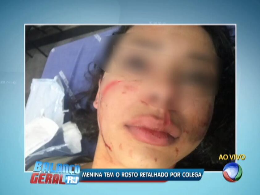 Jovem teve o rosto retalhado
após curtir comentário na internet