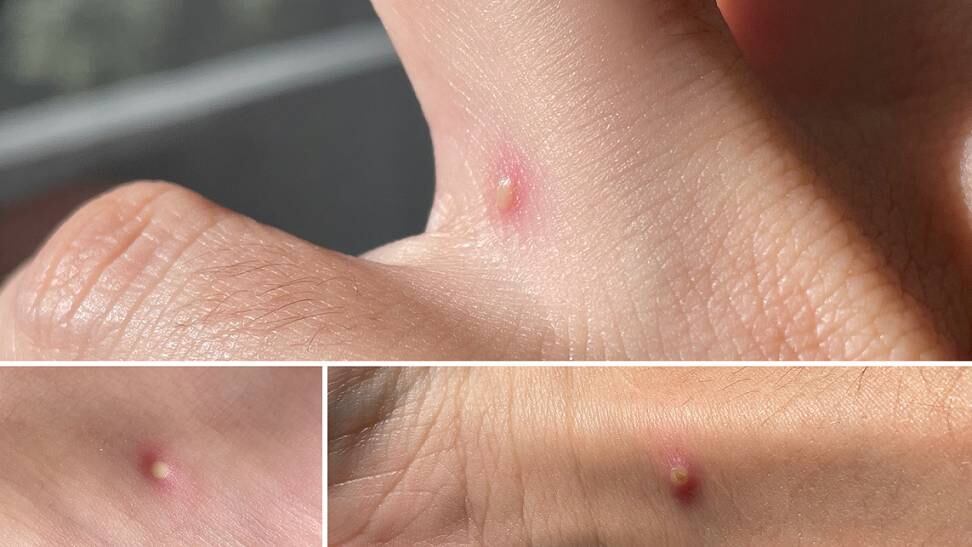 Vítima ficou internada em BH, mas não resistiu