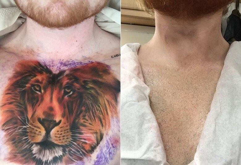 Ed Sheeran: fez ou não fez a tatuagem?