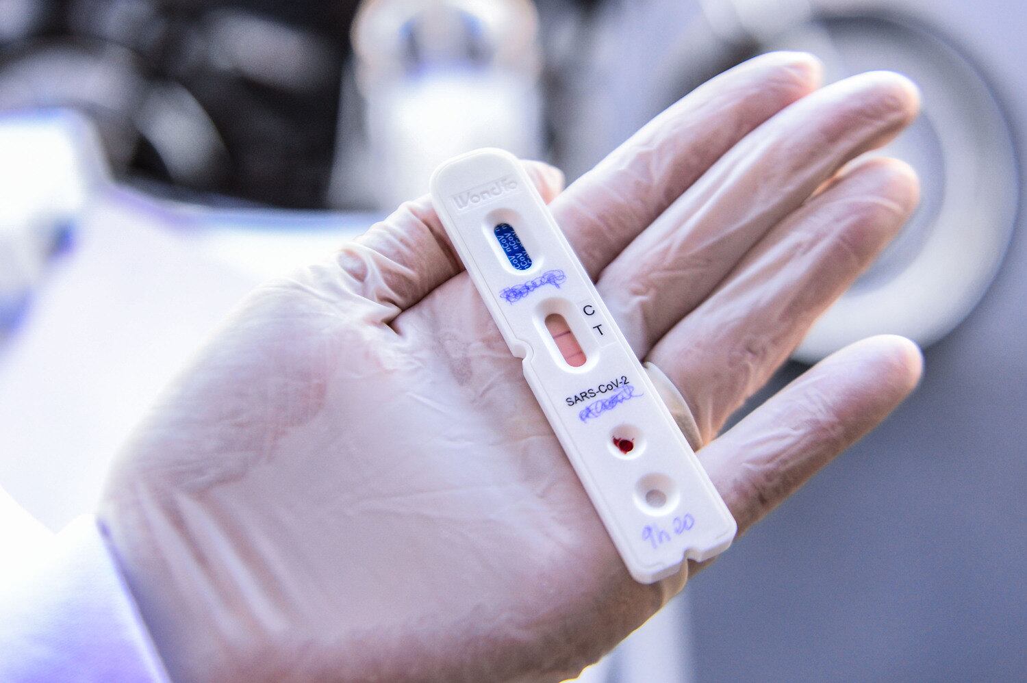 Diretor da Anvisa foi diagnosticado com a doença na sexta-feira (15)