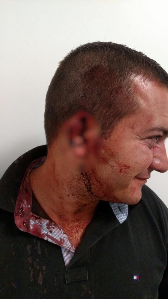 O delegado Luiz Roberto Hellmeister, do 2° DP, disse que o carcereiro e a travesti viveram ‘uma verdadeira briga de rua’.
— Ela chegou aqui e não quis ficar na cela com os outros homens. Foi levada para um seguro (cela isolada), mas também não quis ficar. No momento em que estávamos fazendo um remanejamento, ela atacou o carcereiro e ele deu socos nela. Foi cena de briga de rua mesmo. Aqui é um lugar provisório e não temos celas específicas, como em um presídio