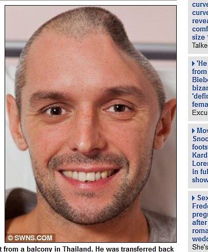 

Durante uma viagem à ilha de Koh Tao,
Lee caiu da sacada da varanda do hotel e bateu o lado esquerdo do crânio,
segundo o site Daily Mail