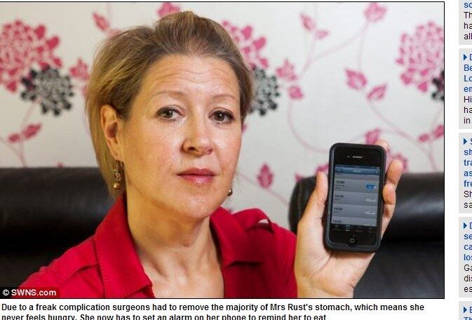 Jo ainda conta que resolveu fazer a cirurgia com a banda gástrica porque estava bem acima do peso e se sentia envelhecida