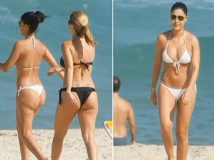 As curvas de Juliana Paes revelam as indesejáveis estrias 

No R7 Play você pode assistir ao
Balanço Geral na íntegra! Clique e experimente de graça!
+ Veja como funciona o tratamento a laser 
+ Você faz algum tratamento contra estrias e celulites? Qual? Conte pra gente!



