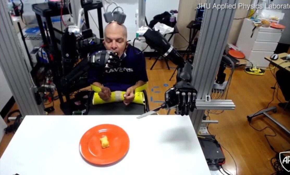 "A ideia é que
ele consiga fazer coisas como amarrar o sapato, da mesma forma que outras pessoas, sem ter de olhar para o que está fazendo", disse