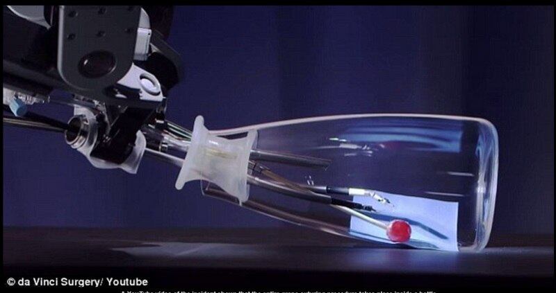 Com movimentos sutis e delicados, o robô costurou a casca
da uva, inclusive fazendo os pontos, como se fosse uma pele humana