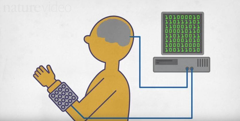 Durante esse período, ele utilizou uma luva e aprendeu a concentrar seus pensamentos de uma forma que os médicos descreveram como "menos natural"