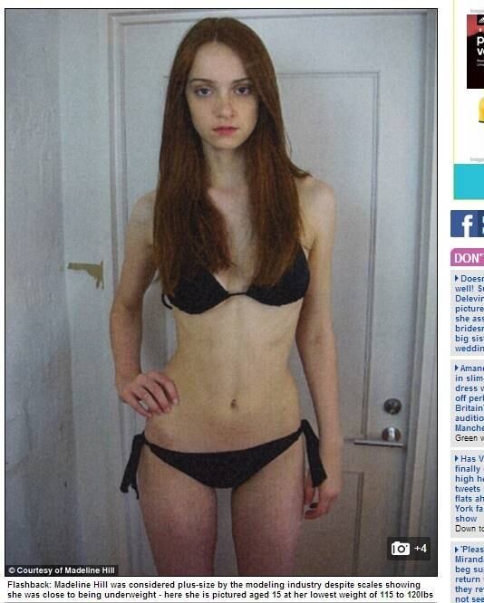 Madeline Hill, aos 19 anos, recebeu uma das notícias que nenhuma mulher gostaria de ouvir: estava gorda demais. No entanto, não era sua balança que dizia isso. Com 61 kg e IMC (índica de massa corpórea) de 18,8, seu agente disse que ela teria tudo para ser uma new face no ramo da moda, mas que estaria gorda demais