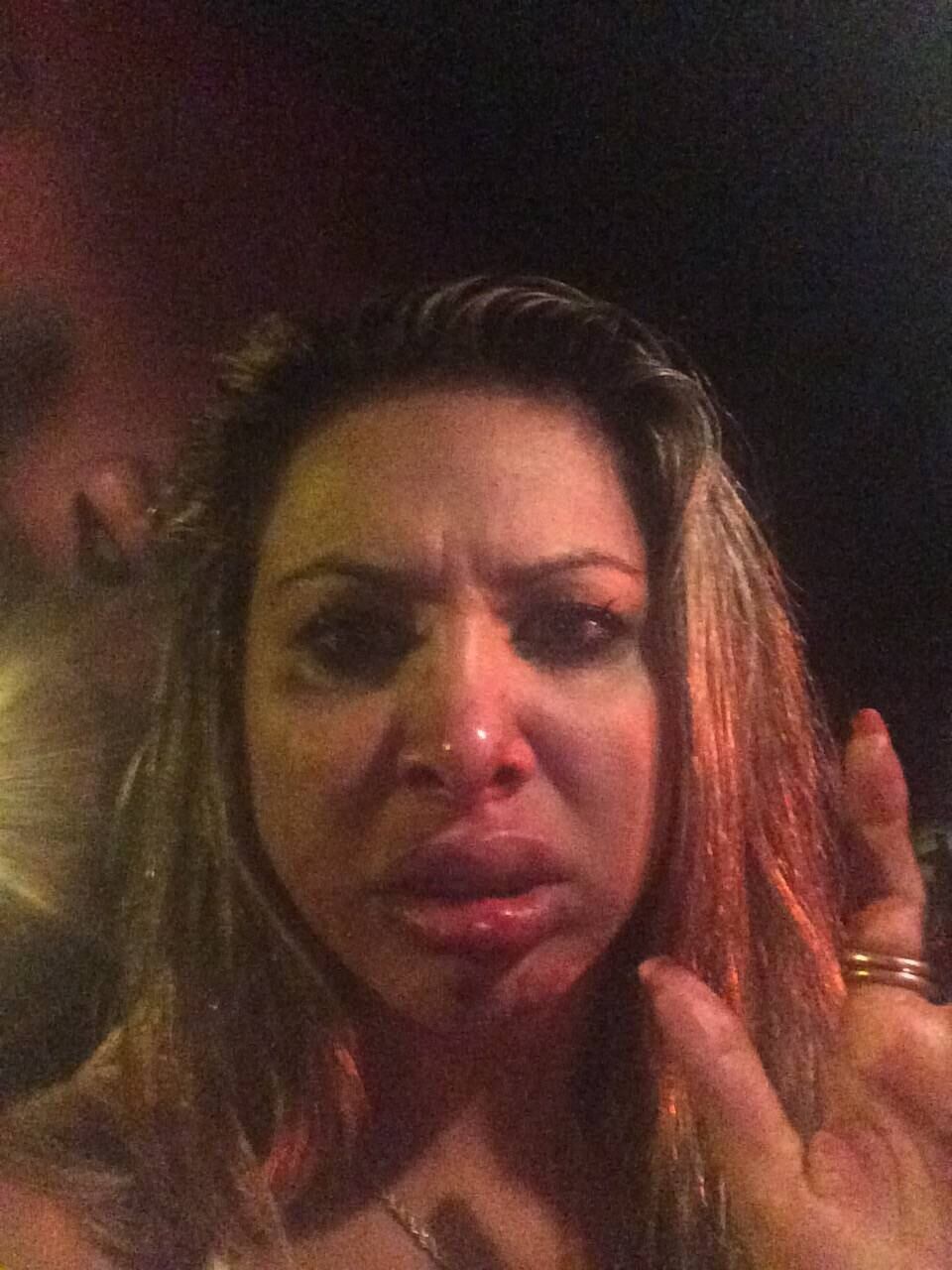 Mas ao ver a namorada e a Miss Bumbum brigando, o suposto agressor teria dado um soco no rosto da modelo, que foi arremessada longe.

— Ele é um covarde, eu não vi de onde veio o soco, mas estourou o meu nariz e minha boca