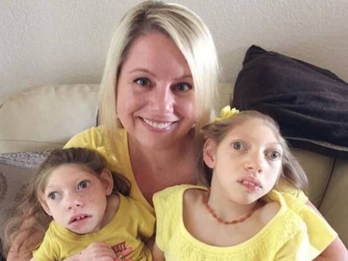 Quando
as filhas de Gwen Hartley nasceram, ela ouviu dos médicos que as pequenas não
passariam do primeiro aniversário. Hoje, Claire tem 14 e Lola 9 anos
+ Médicos fazem cesárea de emergência e não encontram bebê
+ Acesse R7 Play e assista às íntegras do Hoje em Dia! Clique e experimente de graça!