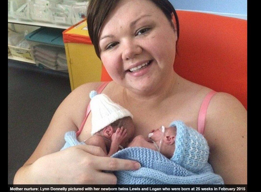 Lynn Donnelly, de North Lanarkshire, na Escócia, deu à luz
seus filhos gêmeos Lewis e Logan em fevereiro de 2015, com apenas 25 semanas de
gravidez. Porém, de acordo com o site DailyMail, Os médicos responsáveis pelo caso alertaram Lynn que era pouco provável que os bebês sobrevivessem à primeira noite