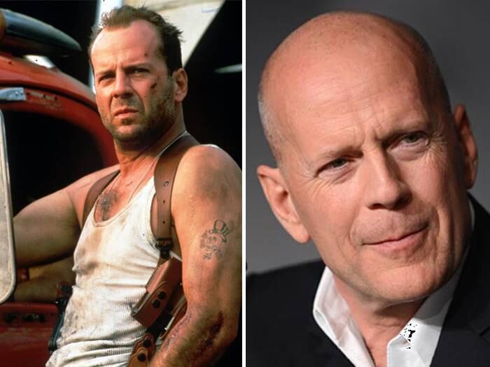 E
Bruce Willis radicalizou! Já que é para ser careca, raspou o que faltava e
assumiu o visual

+ Nova técnica de implante capilar conquista adeptos no Brasil. Entenda!
