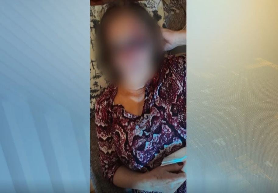 Senhora de 62 anos foi espancada por motorista
