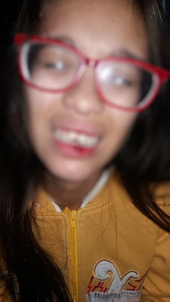 Jovem teve dente quebrado em agressão