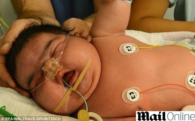 Bebê com 6 kg nasce de parto normal na Alemanha