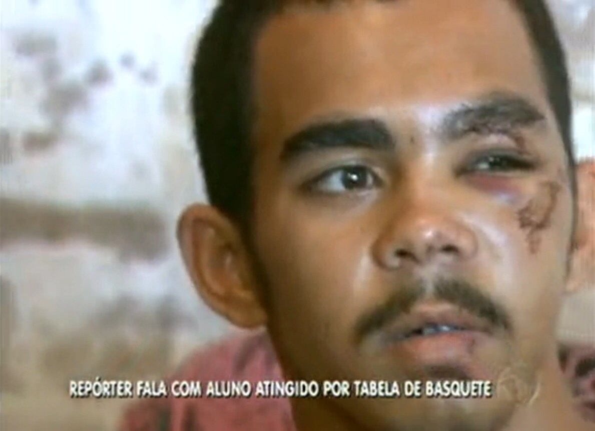 Ele tem dificuldades para abrir a boca por causa da dor que sente ao falar e também quando come. A família acusa a escola de não ter prestado o devido socorro ao jovem