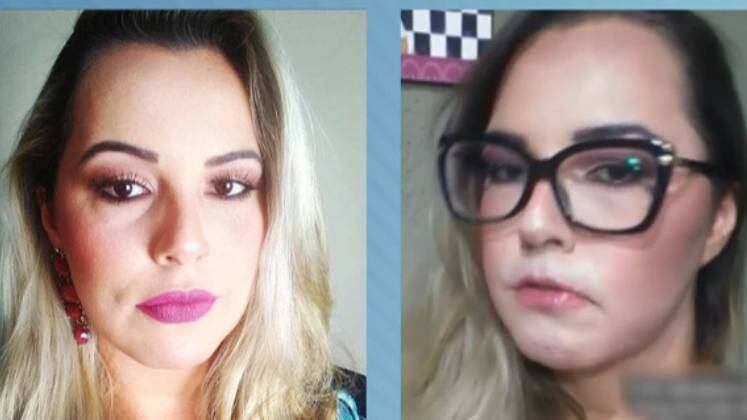 O produto causou uma reação grave e a influenciadora teve que recorrer a um cirurgião plástico para fazer a remoção. "Esse produto corroeu as células. Não tinha mais músculos no rosto, não tinha como fazer a reconstrução labial", explica Mariana. Agora, ela luta para tentar corrigir o erro