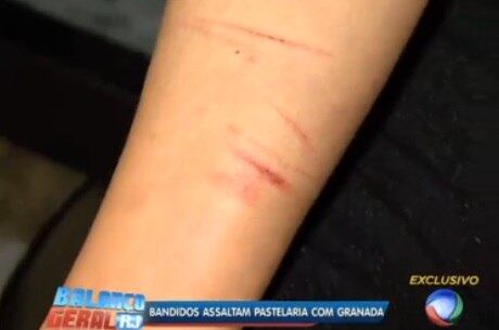 Funcionário de pastelaria foram agredidos durante assalto
