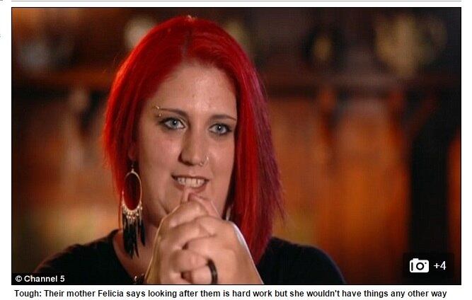 Felicia explica que a melhor
maneira de descrever a maneira como as gêmeas são unidas é pensar em um zíper.
É como se houvesse dois cérebros diferentes, porém fundidos de uma maneira que
não poderão ser desconectados nunca mais.




A aparência
das meninas obviamente chama atenção das pessoas, e muitas vezes outras
crianças perguntam por que elas são “coladas”. Tatiana e Krista não têm
qualquer tipo de constrangimento em explicar a situação.



— Nós
crescemos juntas na barriga da mamãe, e por isso ficamos assim



Confira o R7 Play e assista à programação da Record na íntegra