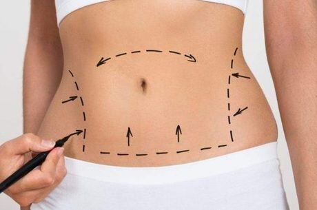 Cirurgia plástica só pode ser realizada por especialista