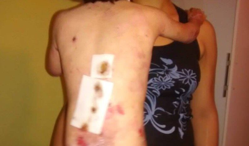 Apesar de todas as dificuldades, a mãe conta que a filha é muito alegre