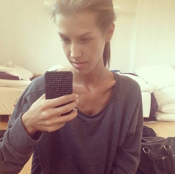 Há 15 meses a sueca Antonia Eriksson, 18 anos, resolveu tornar pública sua luta contra a anorexia. Ela foi internada para tratar o distúrbio alimentar e resolveu contar o passo a passo de sua recuperação no Instagram. Veja