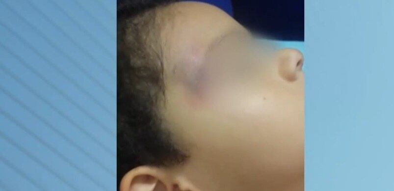 Em 2014, antes das denúncias terem ganho repercussão, uma mãe tirou o filho da escola Colmeia Mágica depois de perceber alguns hematomas no corpo da criança. "Meu filho ficava muito retraído quando eu ia deixá-lo. Ele se agarrava com toda a força em mim, não queria ficar de jeito nenhum, chorava bastante. Tinha vezes que chegava em casa com hematomas", contou a mulher