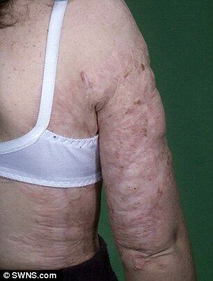 Composto por uma mistura de sal marinho, óleo de semente de cenoura e cera de abelha, o hidratante para a pele foi criado por Jane depois de ela se dar conta de que suas cicatrizes ficavam "mais suaves" depois de um mergulho no mar