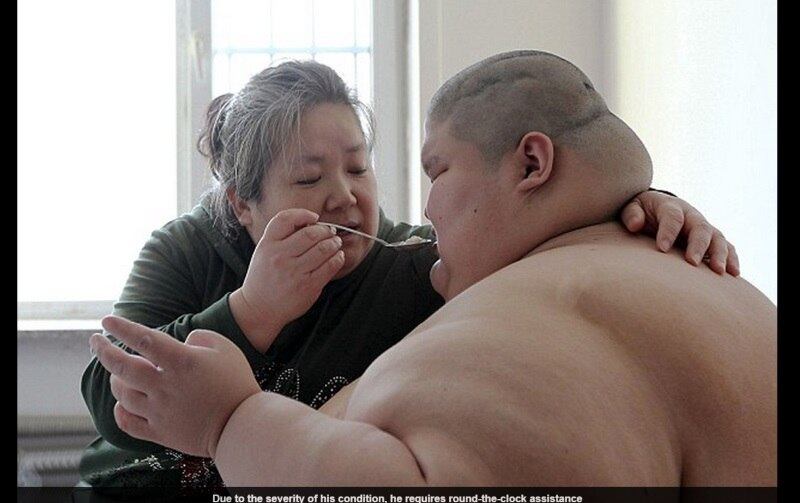 Por causa do seu problema, ele precisa de muita
atenção da mãe. Ações como trocar de roupa e comer ele não consegue fazer
sozinho