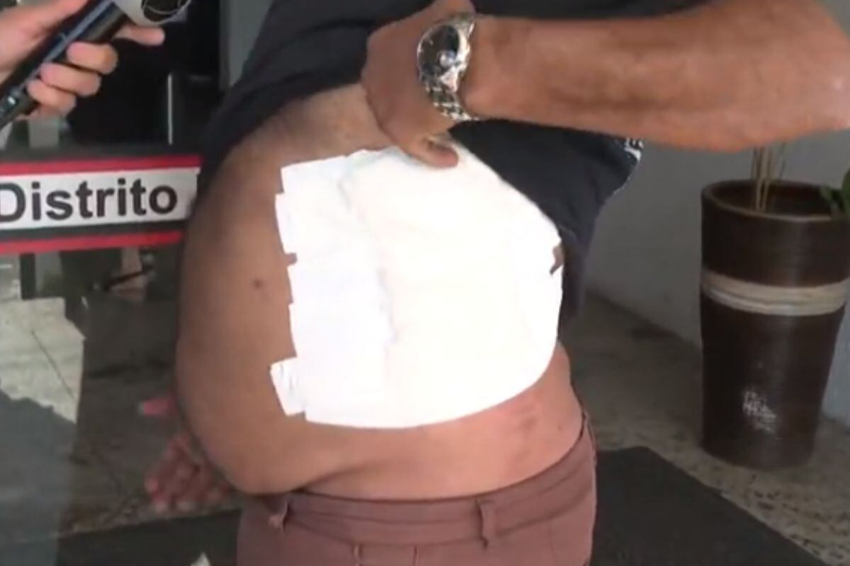 Gilvanio foi esfaqueado no abdômen