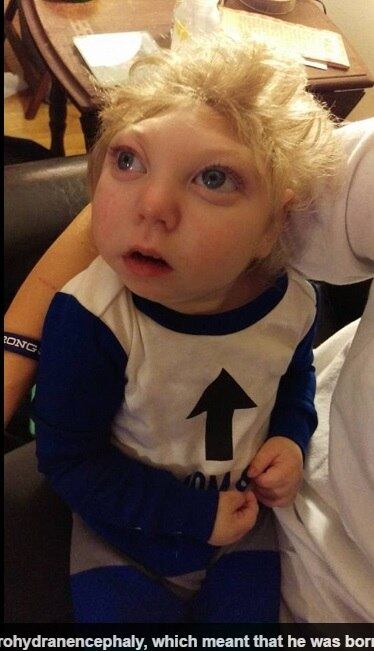 De uma criança que nunca se esperou poder andar, falar,
ouvir ou qualquer outra coisa, o pequeno já está aprendendo a segurar até objetos, como seus próprios brinquedos