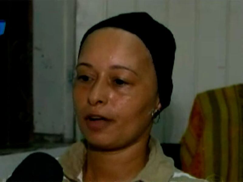 A mulher disse que costumava ir ao salão e nunca tinha tido problemas, mas trocou de tintura no dia, por orientação da cabeleireira, que disse que o produto era muito bom.

— Tudo que queria era meu cabelo de volta
