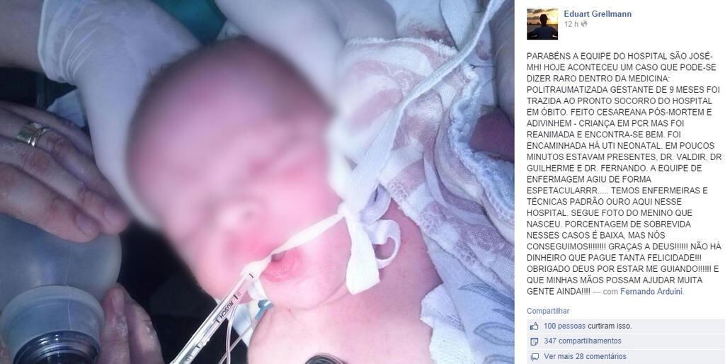O médico que fez o parto postou em sua página no Facebook a foto da criança e o depoimento. O bebê está na UTI (Unidade de Terapia Intensiva), mas não corre risco de morrer
