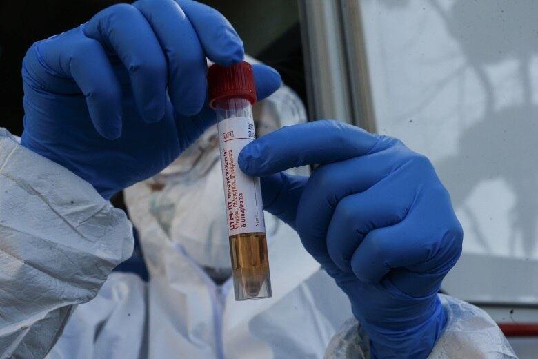 Testagem em massa orienta ações contra a covid-19