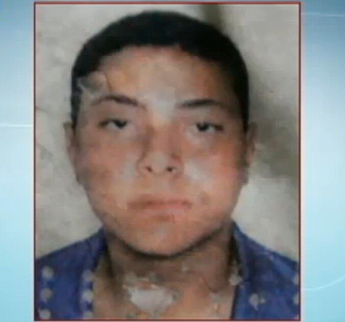 João Vitor (foto) foi baleado na cabeça