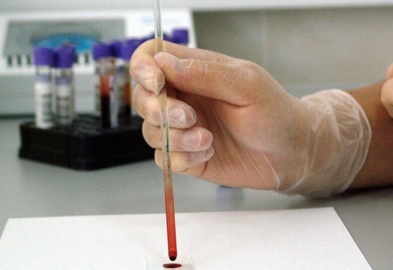 É preciso ficar atento ao tipo de plano contratado. Diferente do modelo hospitalar, o modelo ambulatorial não cobre internações
Assista ao vídeo: Conheça as obrigações do plano de saúde com o cliente
O SP no Ar é exibido de segunda a sexta-feira, a partir das 7h, na tela da Record TV