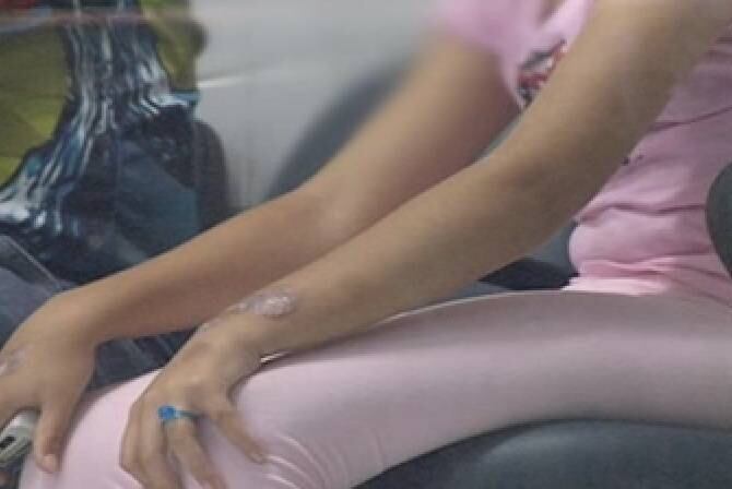 A delegada

Alice
Darce

disse que não há dúvidas das agressões, apesar de a mãe ter negado. A mulher prestou depoimento e foi liberada, mas não poderá mais ter a guarda das meninas. O Conselho Tutelar informou que as encaminhou para o pai