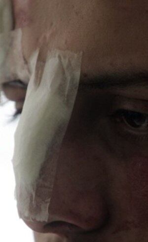 Um dos jovens agredidos na av. Paulista