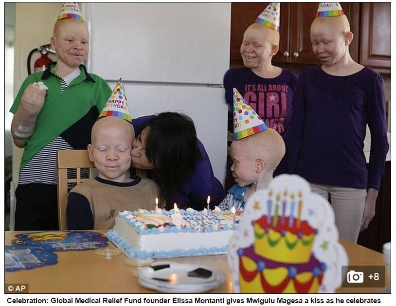 Por esse motivo, membros e pedaços de albinos são vendidos por milhares de dólares no mercado negro da região