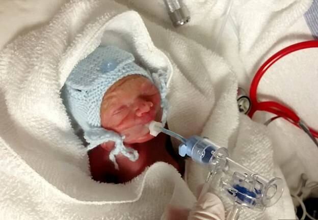 Mhairi afirma que, ao dar a notícia para ela, os médicos saíram
da sala e cinco minutos depois, voltaram com um documento para autorizar o
aborto.
― Quando os médicos voltaram, eu e meu marido
dissemos a eles que iriamos dar uma chance ao nosso filho