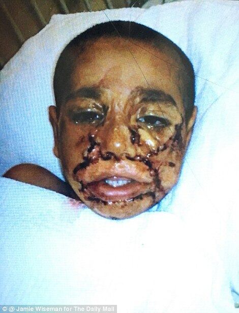 A reportagem do Daily Mail, que visitou a casa do menino, ressaltou
que não  havia espelho na pequena habitação: neste momento, isso iria
atrapalhar a recuperação da criança
