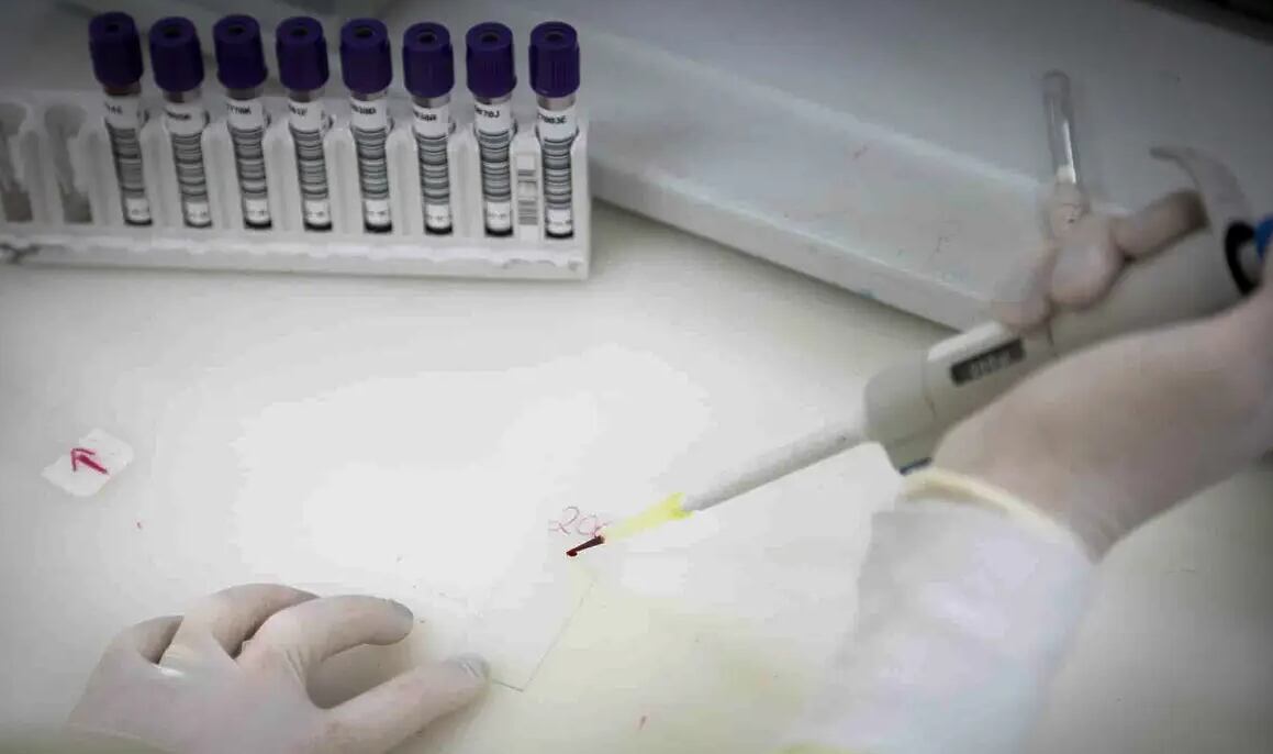 Ebola