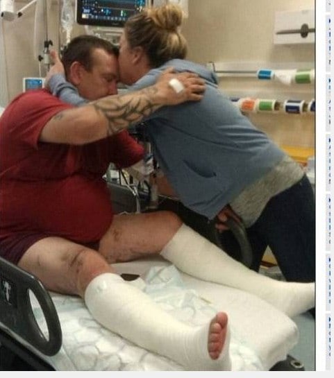 Cigarro eletrônico
explode e quase "amputa" perna de inglês. Veja o que aconteceu!