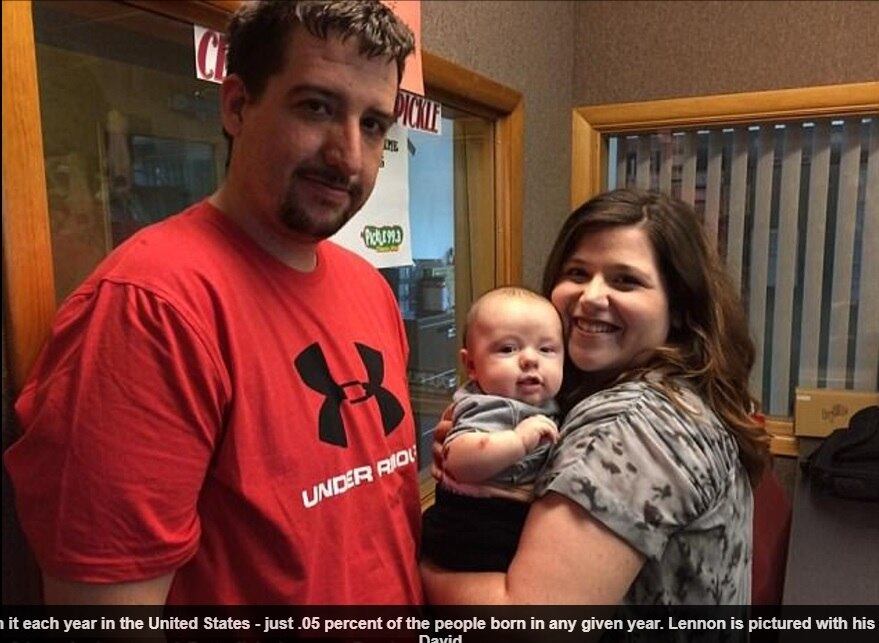 Shelby, a mãe de Lennon Gregory, explica que teve uma ótima
gravidez e que não havia motivos para suspeitar de uma doença como essa, mas
logo após o nascimento os médicos disseram que algo estava errado com ele. 


— Eles afirmaram que ele estava começando a ficar cheio de bolhas e
acharam que eram causadas por uma infecção por estafilococos ou por herpes. Mas
começou a se espalhar. Ele foi isolado e, quando os médicos tiraram
suas meias, pedaços de pele de seu tornozelo saíram e eles sabiam que era algo realmente
sério