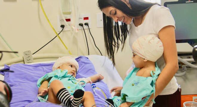 Mel e Lis nasceram grudadas pelo crânio e tiveram alta hospitalar nesta terça