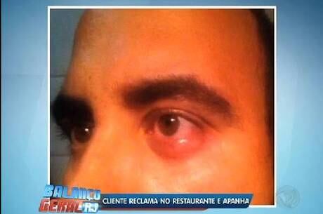 Após a reclamação, a vítima foi agredida com um soco no olho