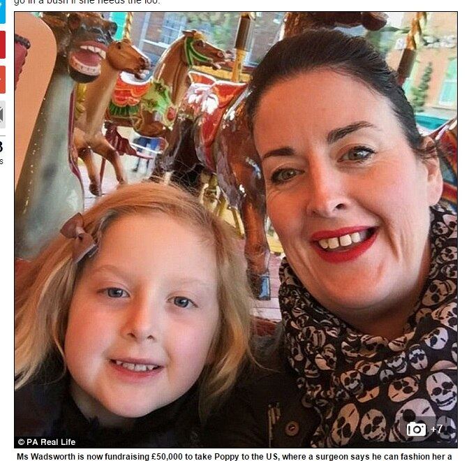 No entanto, como o
problema de Poppy é muito raro e grave, um hospital americano decidiu arcar com
metade dos custos de uma operação que pode mudar sua vida para sempre. Em
contrapartida, eles estudariam seu caso e desenvolveriam pesquisas a respeito
do assunto.




Mark Levett,
um especialista de Ohio, deve realizar uma cirurgia em breve que permitirá que
Poppy use o banheiro normalmente, e, quem sabe, que ela também possa, um dia,
vir a ter filhos sem problemas. Durante o procedimento, uma vagina será
desenhada para Poppy, sua bexiga será reconstruída, seu rim passará por reparos
e um de seus úteros será removido