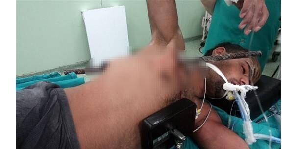 Ele aterrissou no chão bem
em cima de uma barra de metal, que penetrou seu peito e saiu pelas suas costas
